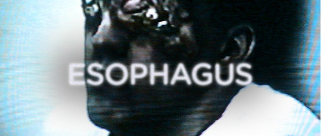 esophagus-banner